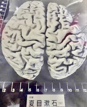 人間の脳の模型が横から見える画像。脳の側面と表面の構造が詳細に示されている。